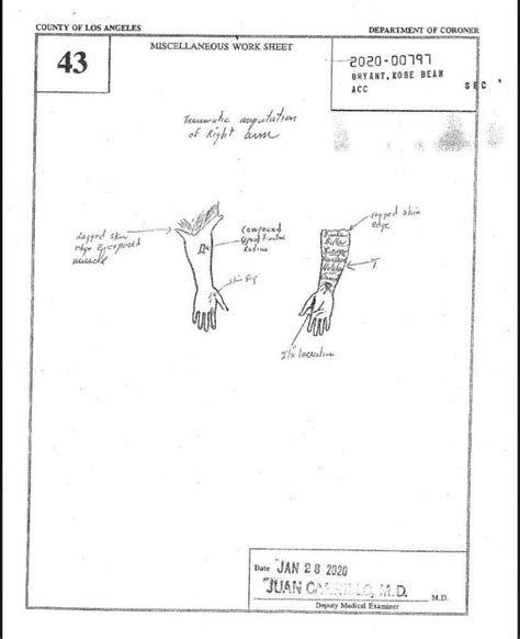 gigi autopsy sketch|Gianna Bryant 